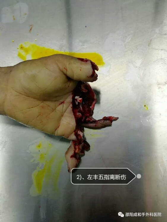 邵陽創(chuàng)傷骨科,邵陽風(fēng)濕病區(qū),邵陽骨質(zhì)增生,邵陽關(guān)節(jié)病區(qū),邵陽頸椎病區(qū)