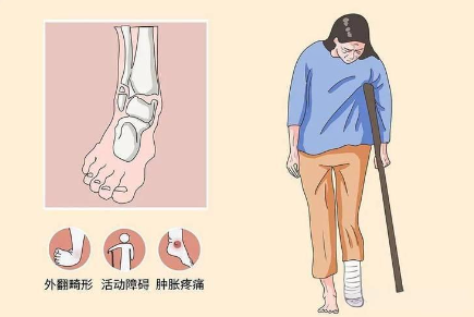 邵陽創(chuàng)傷骨科,邵陽風濕病區(qū),邵陽骨質(zhì)增生,邵陽關節(jié)病區(qū),邵陽頸椎病區(qū)