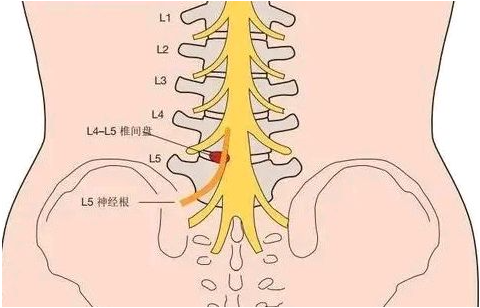 邵陽創(chuàng)傷骨科,邵陽風濕病區(qū),邵陽骨質增生,邵陽關節(jié)病區(qū),邵陽頸椎病區(qū)