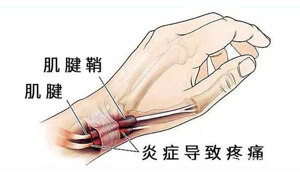 邵陽創(chuàng)傷骨科,邵陽風濕病區(qū),邵陽骨質(zhì)增生,邵陽關節(jié)病區(qū),邵陽頸椎病區(qū)