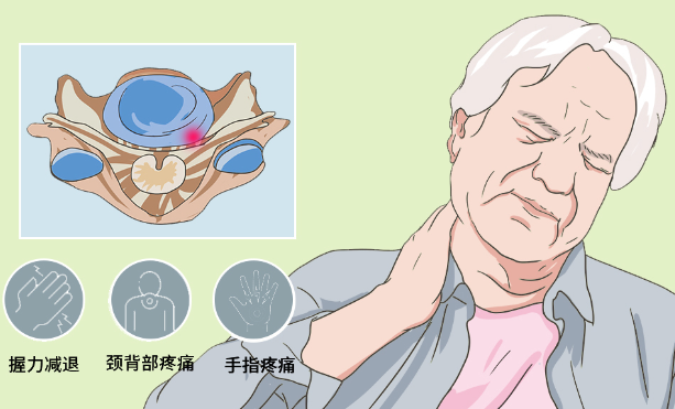 邵陽創(chuàng)傷骨科,邵陽風濕病區(qū),邵陽骨質(zhì)增生,邵陽關節(jié)病區(qū),邵陽頸椎病區(qū)